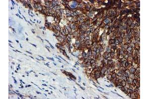 Image no. 5 for anti-Makorin Ring Finger Protein 1 (MKRN1) antibody (ABIN1499486)