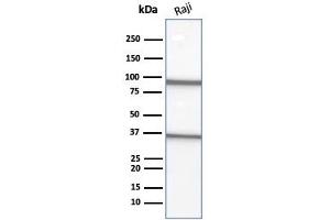 Western Blot Analysis of Raji cell lysate using CD20 Mouse Monoclonal Antibody (L26). (CD20 antibody)