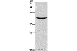 Western blot analysis of Mouse pancreas tissue, using GIPR Polyclonal Antibody at dilution of 1:150