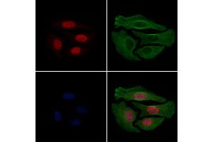 ABIN6256332 and ABIN6267233 staining Hela cells(4h of LPS treatment) by IF/ICC. (HDAC3 antibody  (pSer424))