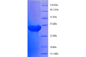 SDS-PAGE (SDS) image for Ribosomal Protein L29 (RPL29) (AA 1-63), (full length) protein (GST tag) (ABIN5712636) (RPL29 Protein (AA 1-63, full length) (GST tag))