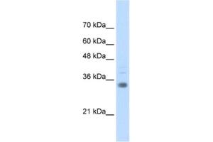 Western Blotting (WB) image for anti-Homeobox B4 (HOXB4) antibody (ABIN2461927)