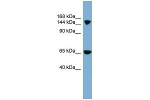 SLC4A5 antibody used at 1 ug/ml to detect target protein. (NBC4 antibody  (Middle Region))