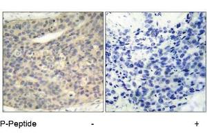 Image no. 1 for anti-LIM Domain Kinase 1 (LIMK1) (pThr508) antibody (ABIN196830) (LIM Domain Kinase 1 antibody  (pThr508))