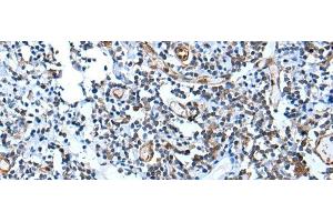 Immunohistochemistry of paraffin-embedded Human tonsil tissue using USP37 Polyclonal Antibody at dilution of 1:45(x200) (USP37 antibody)