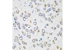 Immunohistochemistry of paraffin-embedded rat brain using EEF1G antibody at dilution of 1:100 (40x lens).