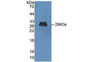 Detection of Recombinant ChAT, Human using Polyclonal Antibody to Choline Acetyltransferase (ChAT)