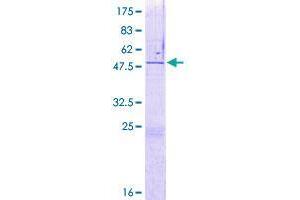 Image no. 1 for Zinc Finger Protein 771 (ZNF771) (AA 1-275) protein (GST tag) (ABIN1326428) (ZNF771 Protein (AA 1-275) (GST tag))