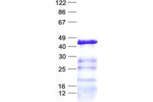 Validation with Western Blot (DHRS13 Protein (His tag))