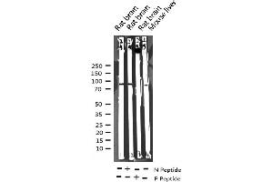 Western blot analysis of Phospho-ADAM 17 (Thr735) expression in various lysates (ADAM17 antibody  (pThr735))