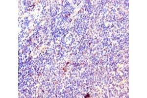 Immunohistochemistry of paraffin-embedded human lymphoid tissue using ABIN7142808 at dilution of 1:100 (RPL35A antibody  (AA 1-110))