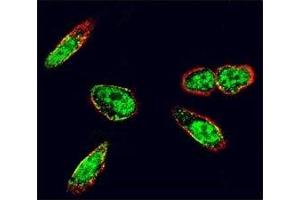 Confocal immunofluorescent analysis of c-Src antibody with A375 cells followed by Alexa Fluor 488-conjugated goat anti-rabbit lgG (green). (Src antibody  (AA 1-30))