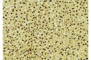 ABIN6276714 at 1/100 staining Mouse liver tissue by IHC-P. (ANG antibody  (Internal Region))