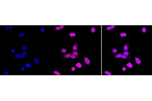 Immunocytochemical staining of HAP-1 cells with PCBP1 antibody (ABIN7800958), 1:1,000).