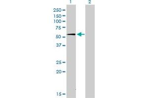 Western Blot analysis of SUOX expression in transfected 293T cell line by SUOX monoclonal antibody (M01), clone 1H1. (SUOX antibody  (AA 1-488))