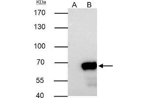 IP Image Nucleoporin p62 antibody immunoprecipitates NUP62 protein in IP experiments.