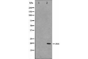 Western blot analysis on LOVO cell lysate using JM4 Antibody.