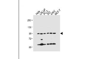 All lanes : Anti-PKN beta Antibody (C-term) at 1:500 dilution Lane 1: Hela whole cell lysate Lane 2: LNCaP whole cell lysate Lane 3: PC-3 whole cell lysate Lane 4: 293 whole cell lysate Lane 5: K562 whole cell lysate Lane 6: MCF-7 whole cell lysate Lysates/proteins at 20 μg per lane. (PKN beta antibody  (C-Term))