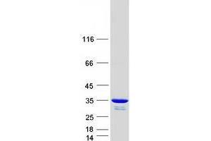 Validation with Western Blot