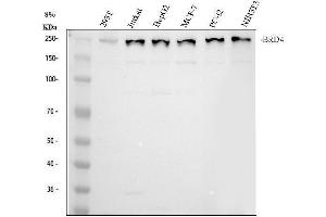 Western blot analysis of BRD4 using anti-BRD4 antibody (ABIN7602518).