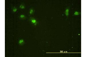 Immunofluorescence of monoclonal antibody to CDC2L5 on HeLa cell.