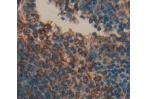 Used in DAB staining on fromalin fixed paraffin- embedded Kidney tissue (LAT2 antibody  (AA 29-193))