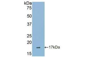 Detection of Recombinant SIGLEC7, Human using Polyclonal Antibody to Sialic Acid Binding Ig Like Lectin 7 (SIGLEC7) (SIGLEC7 antibody  (AA 38-121))