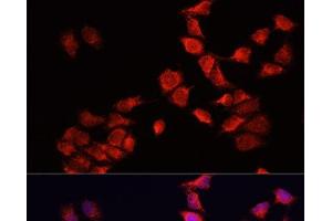 Immunofluorescence analysis of HeLa cells using BNIP3 Polyclonal Antibody at dilution of 1:100. (BNIP3 antibody)