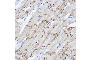 Immunohistochemistry of paraffin-embedded Rat heart using Connexin 43 Rabbit pAb (ABIN6131701, ABIN6141098, ABIN6141099 and ABIN6215448) at dilution of 1:100 (40x lens). (Connexin 43/GJA1 antibody  (AA 233-382))