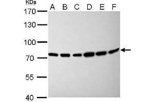 WB Image Moesin antibody [C2C3], C-term detects MSN protein by Western blot analysis. (Moesin antibody  (C-Term))