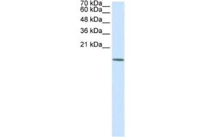 Western Blotting (WB) image for anti-Histone Deacetylase 6 (HDAC6) antibody (ABIN2460227) (HDAC6 antibody)
