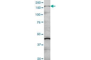 COL5A1 monoclonal antibody (M01), clone 2F4 Western Blot analysis of COL5A1 expression in Hela S3 NE . (COL5A1 antibody  (AA 1-591))