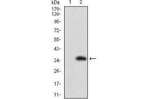 Western blot analysis using SLC27A2 mAb against HEK293 (1) and SLC27A2 (AA: 346-405)-hIgGFc transfected HEK293 (2) cell lysate. (SLC27A2 antibody  (AA 346-405))