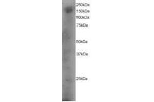 Image no. 1 for anti-Dedicator of Cytokinesis 1 (DOCK1) (AA 1852-1865) antibody (ABIN295982) (DOCK1 antibody  (AA 1852-1865))