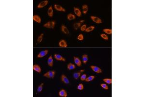 Immunofluorescence analysis of L929 cells using GNB1 Rabbit pAb (ABIN6129389, ABIN6141219, ABIN6141220 and ABIN6219000) at dilution of 1:100 (40x lens). (GNB1 antibody  (AA 1-340))