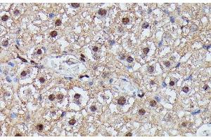 Immunohistochemistry of paraffin-embedded Mouse liver using IGHMBP2 Polyclonal Antibody at dilution of 1:100 (40x lens). (IGHMBP2 antibody)