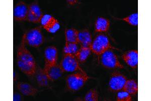 Immunofluorescence staining of vesicles (red) in RBL-2H3 rat basophilic leukemia cell line using anti-Kinesin (KN-03).