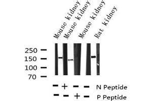 Western blot analysis of Phospho-VEGFR2 (Tyr951) expression in various lysates (VEGFR2/CD309 antibody  (pTyr951))