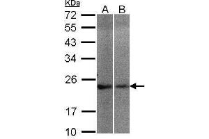WB Image Sample(30 μg of whole cell lysate) A:A431, B:Hep G2, 12% SDS PAGE antibody diluted at 1:200 (NCS1 antibody)