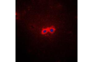 Immunofluorescent analysis of Cytochrome P450 26A1 staining in HepG2 cells. (CYP26A1 antibody  (Center))