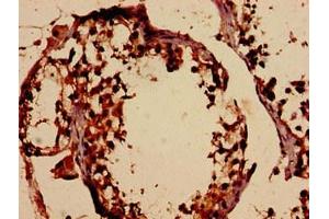 Immunohistochemistry analysis of human testis tissue using ABIN7159195 at dilution of 1:100 (DMC1 antibody  (AA 5-153))