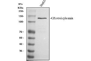 Western blot analysis of Ceruloplasmin using anti-Ceruloplasmin antibody (ABIN3044507). (Ceruloplasmin antibody  (AA 20-259))