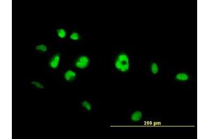 Immunofluorescence of monoclonal antibody to NR4A3 on HeLa cell. (NR4A3 antibody  (AA 414-521))