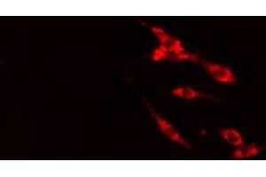 ABIN6275451 staining HeLa cells by IF/ICC. (G3BP2 antibody  (C-Term))