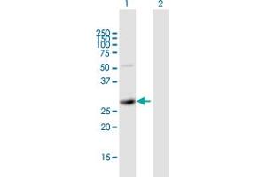 Western Blot analysis of SIRT5 expression in transfected 293T cell line by SIRT5 MaxPab polyclonal antibody. (SIRT5 antibody  (AA 1-310))