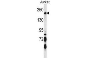 BRIP1 Antibody (N-term) western blot analysis in Jurkat cell line lysates (35µg/lane). (BRIP1 antibody  (N-Term))