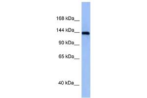 WB Suggested Anti-Tnik Antibody Titration: 1. (TNIK antibody  (Middle Region))
