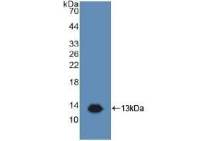 Western Blotting (WB) image for anti-CD81 (CD81) (AA 113-201) antibody (ABIN7433195)