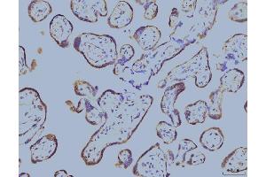 IHC analysis of EIF4A1 using anti-EIF4A1 antibody (ABIN7603144). (EIF4A1 antibody  (N-Term))