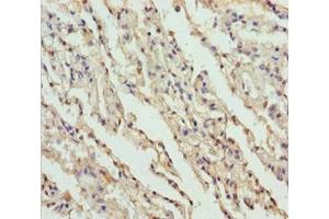 Immunohistochemistry of paraffin-embedded human lung tissue using ABIN7149964 at dilution of 1:100 (FMO5 antibody  (AA 1-285))